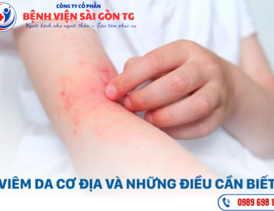 Viêm Da Cơ Địa - Nguyên Nhân, Nhận Biết, Chuẩn Đoán Và Điều Trị