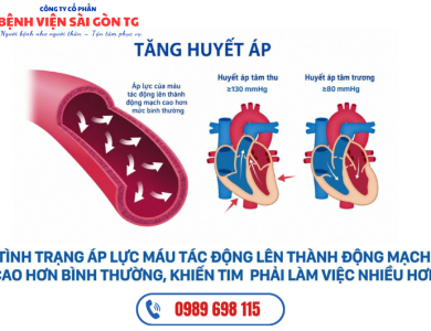Tăng Huyết Áp Là Gì? Nguyên Nhân, Dấu Hiệu, Biến Chứng Và Điều Trị