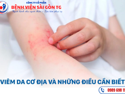 Viêm Da Cơ Địa - Nguyên Nhân, Nhận Biết, Chuẩn Đoán Và Điều Trị