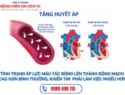 Tăng Huyết Áp Là Gì? Nguyên Nhân, Dấu Hiệu, Biến Chứng Và Điều Trị