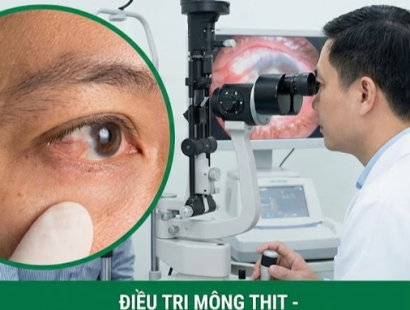 Điều Trị Mộng Thịt & Đục Thủy Tinh Thể