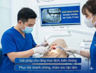 Nhổ Răng Khôn